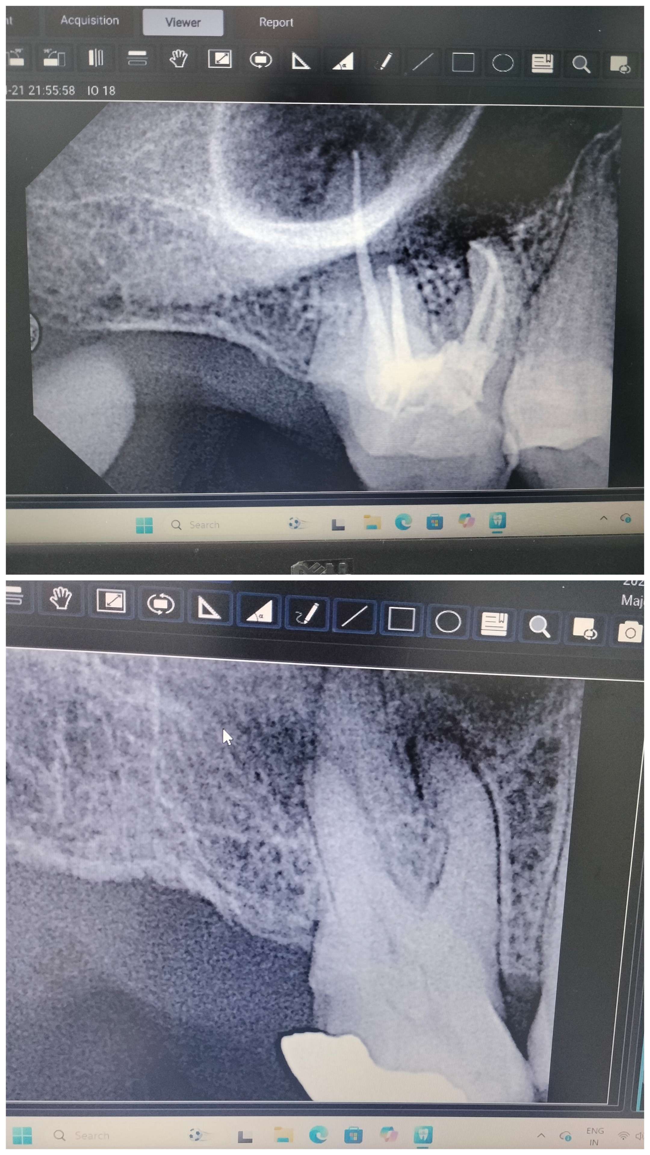Dental X-ray
