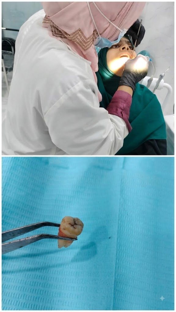 Gentle wisdom tooth extraction procedure and complete root removal
