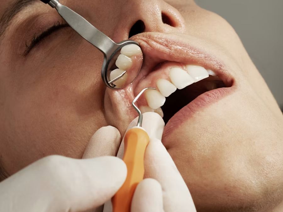Gentle & Painless Anaesthesia